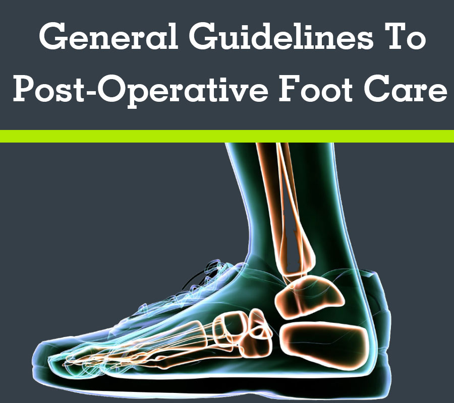 General Guidelines to Post-Operative Foot Care