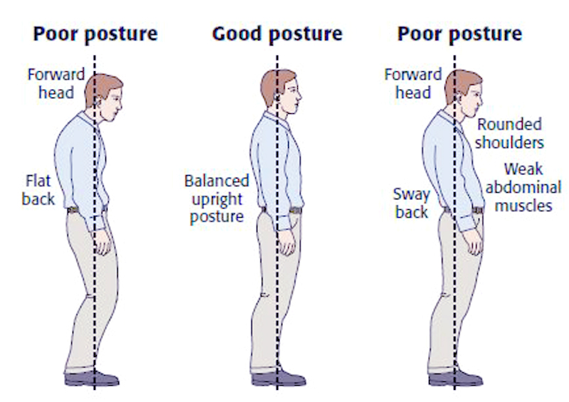 Good and Poor standing posture