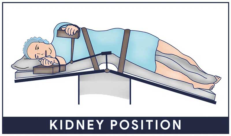 Patient Positioning Cheat Sheet & Complete Guide for 2023