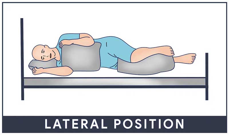 Supine position for casting